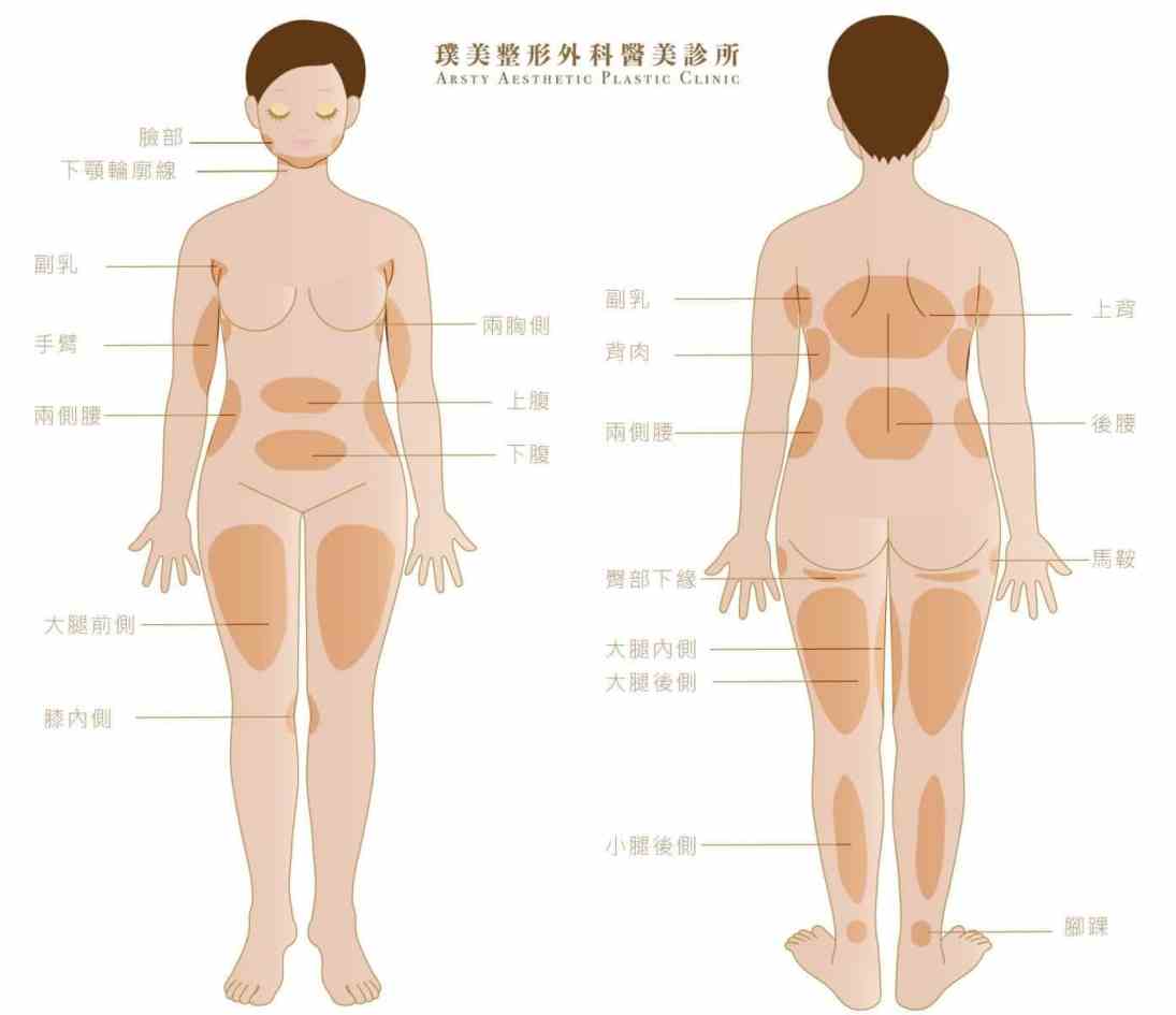 抽脂完凹凸不平 是抽脂失敗嗎 如何補救 璞美整形外科