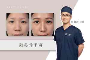 官網_醫師觀點封面-03