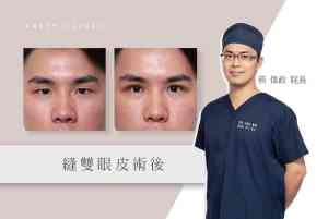 官網_醫師觀點封面-05