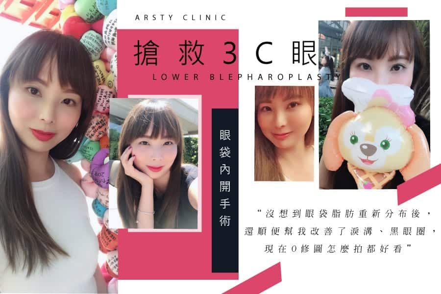 眼袋01-1