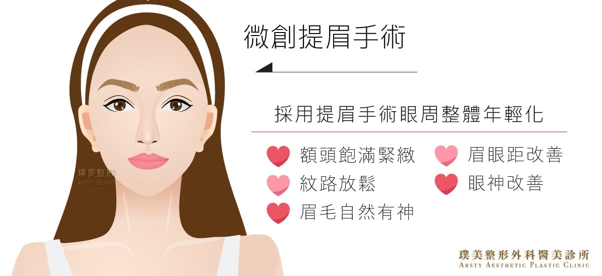 微創提眉手術,採用提眉手術使眼周整體年輕化