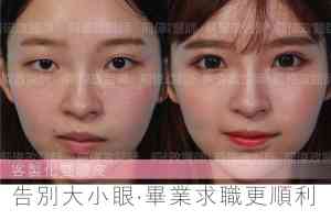 大小眼