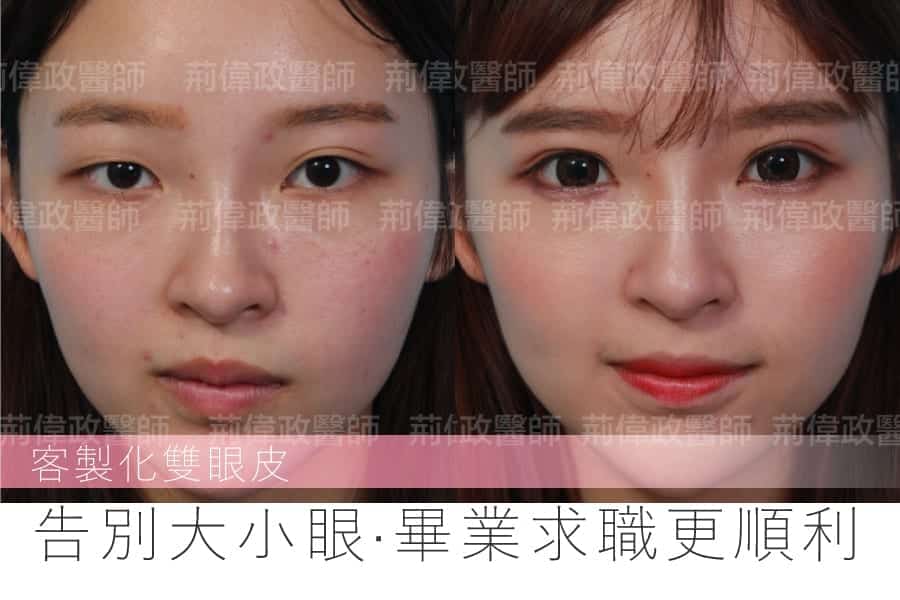 大小眼