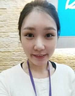 Endoscopic Forehead Lift術後10天後的我，眼神變柔和了