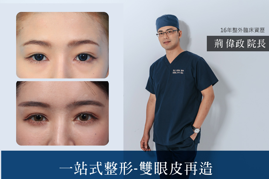 雙眼皮重修雙眼皮再造-一站式整形服務-璞美整形外科