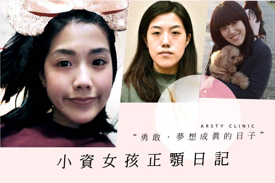 我的正顎日記 為自己的夢想而勇敢 璞美整形外科