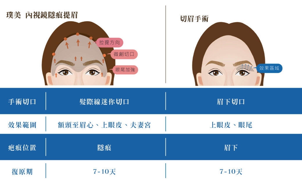 微創提眉及切眉手術比較