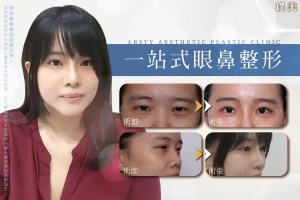 Case Study Cover - Endoscopic Forehead Lift_Augmentation Rhinoplasty_Double Eyelid Surgery - B220807
