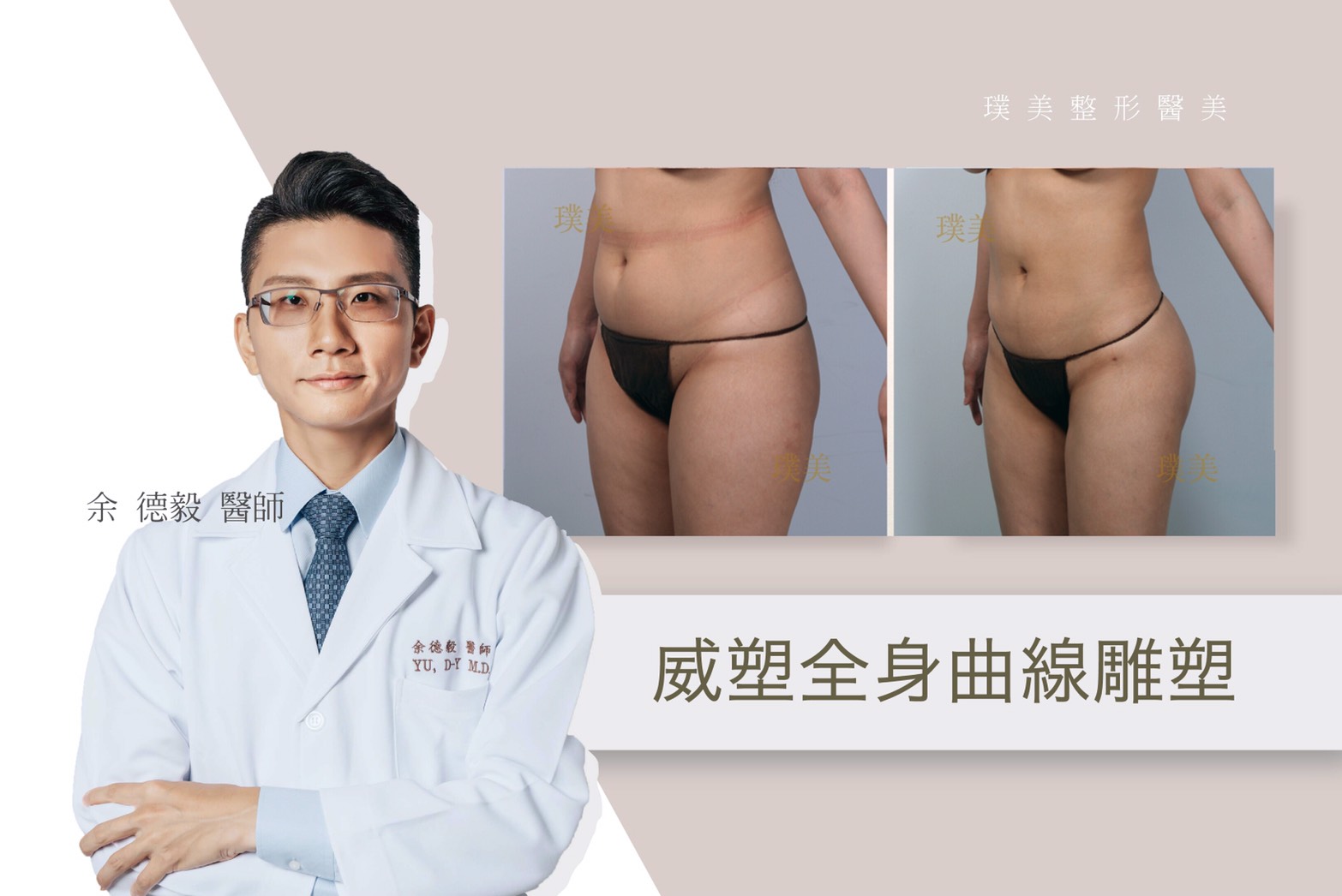 威塑2代抽脂手術雕塑身體態與精緻線條 38 S 100098067