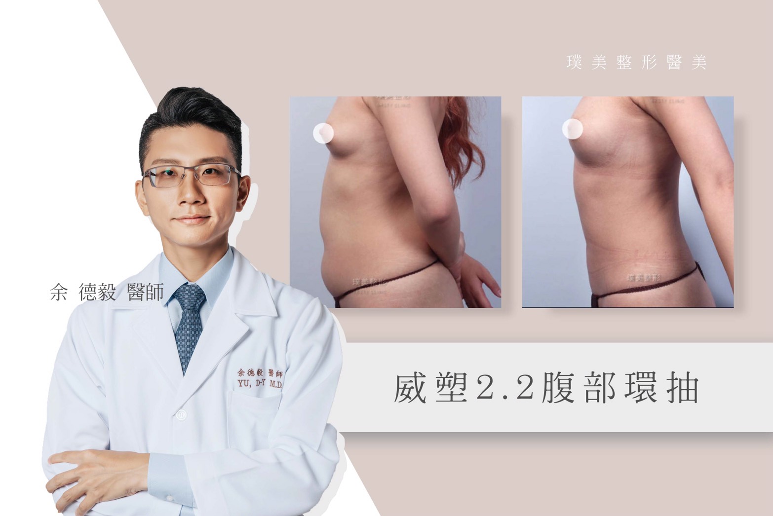 威塑2代抽脂手術雕塑身體態與精緻線條 39 S 100098069