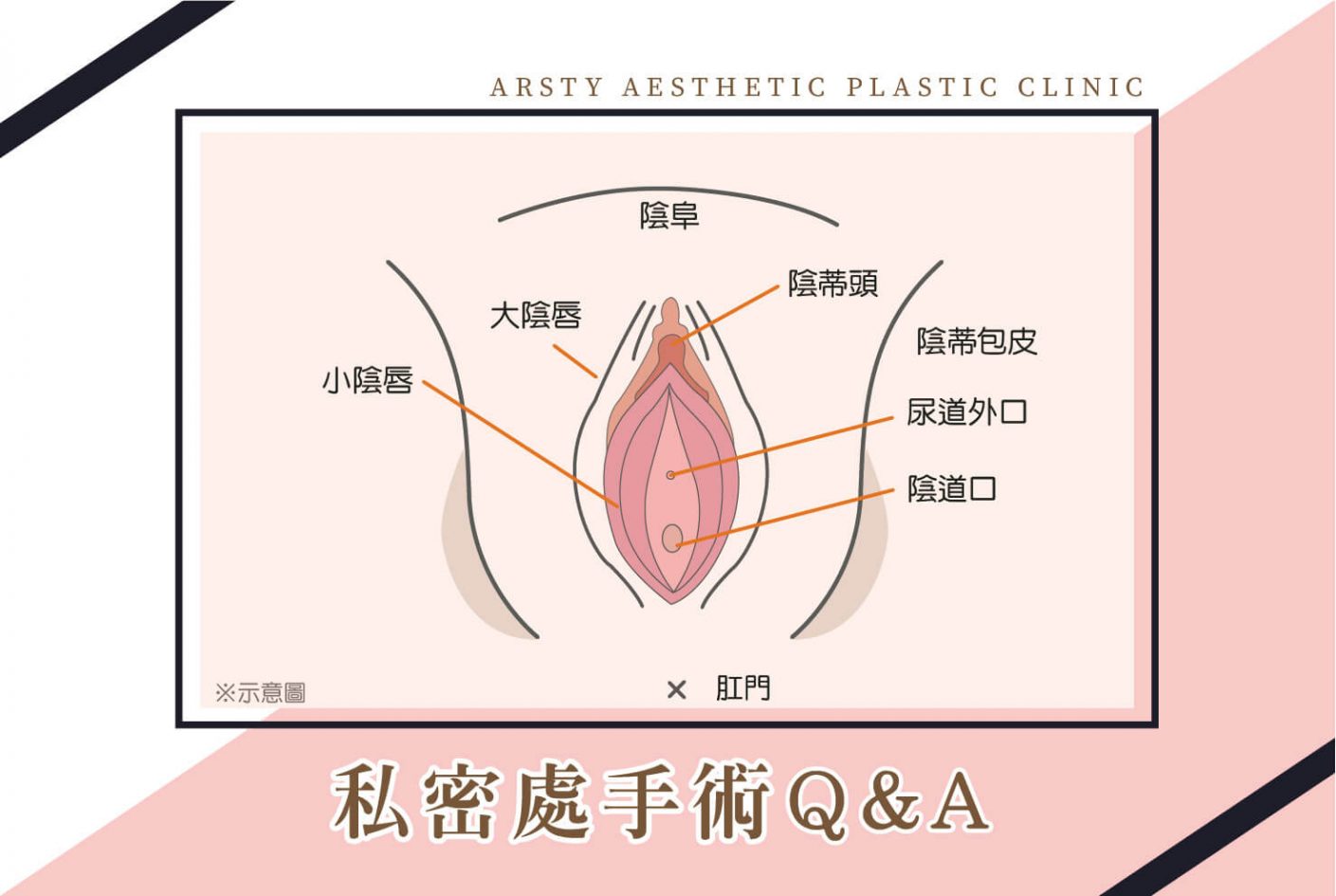 哺 乳 餵 奶 後.一 定 會 奶 頭 變 形 變 長 嗎.可 以 用 手 術 方 式 縮 小 嗎? 