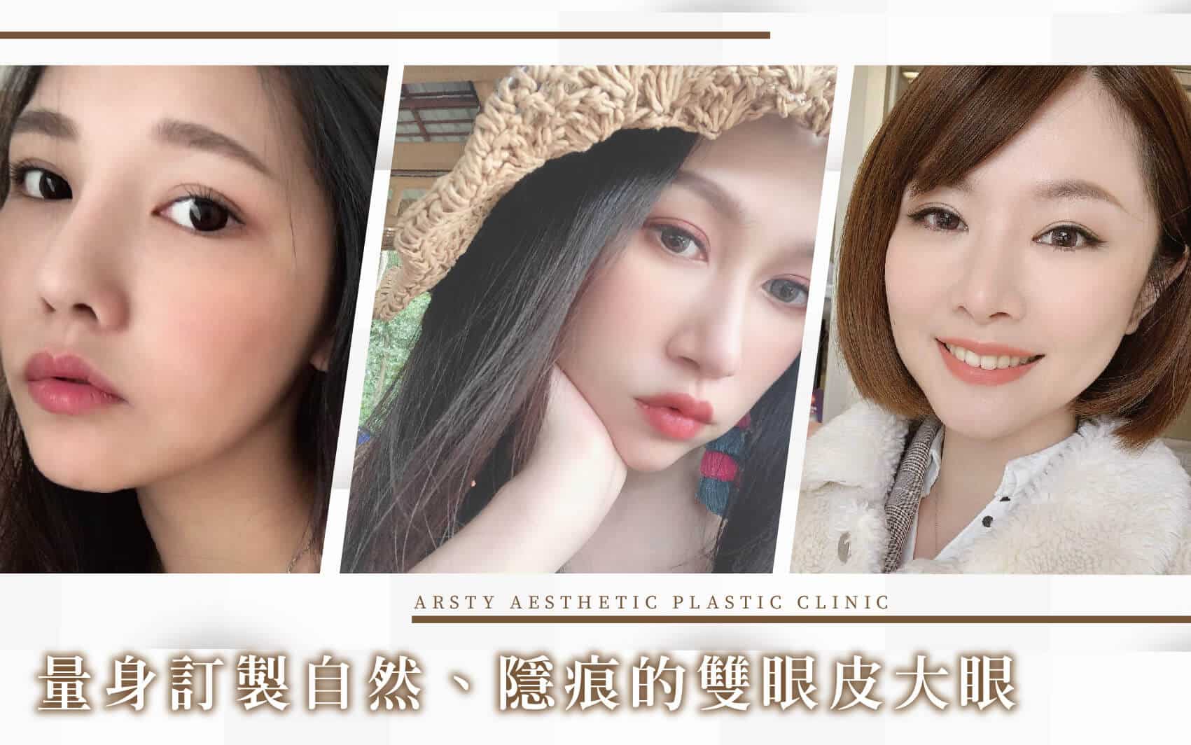 璞美複合式雙眼皮手術Banner-1
