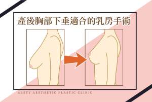 産後の乳房のたるみ - 最初の写真 - 1
