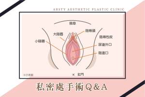 私密處手術QA-1