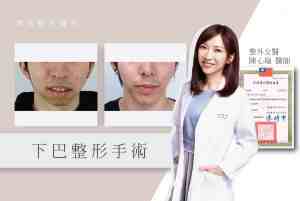 Dr. Chen's Viewpoint_06-1