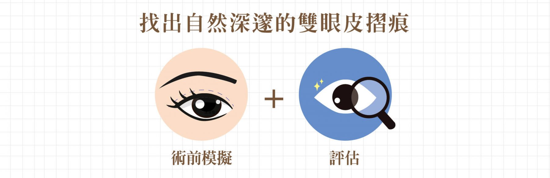 割雙眼皮手術 12 客製化美瞳 1