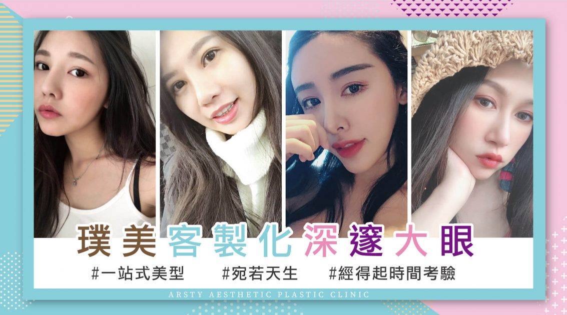 割雙眼皮 8 客製化美瞳 2