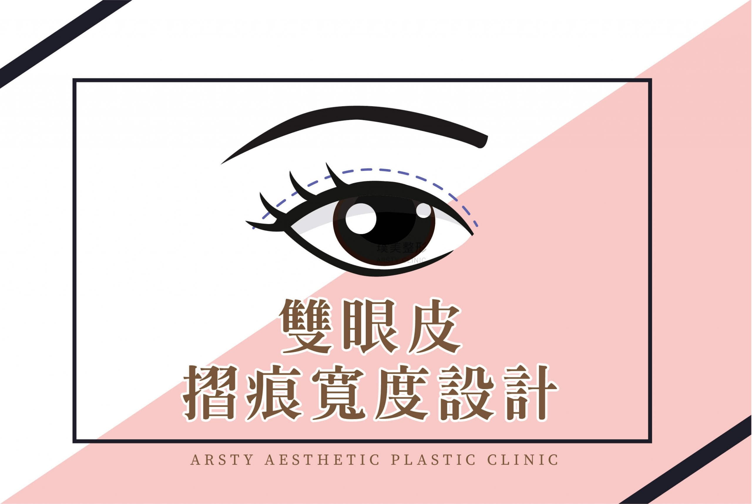 雙眼皮摺痕寬度設計_05-scaled-3