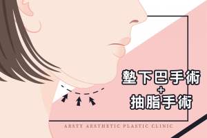 醫學新知封面-墊下巴手術、抽脂手術_10-scaled-3