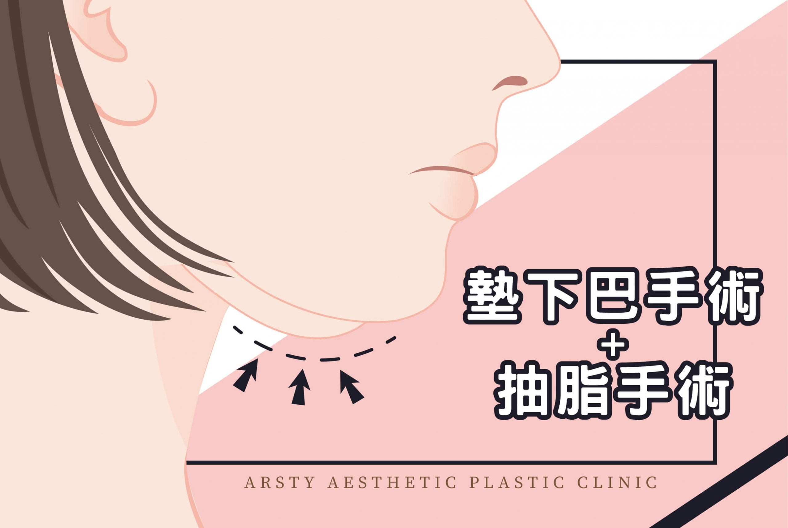 醫學新知封面-墊下巴手術、抽脂手術_10-scaled-3