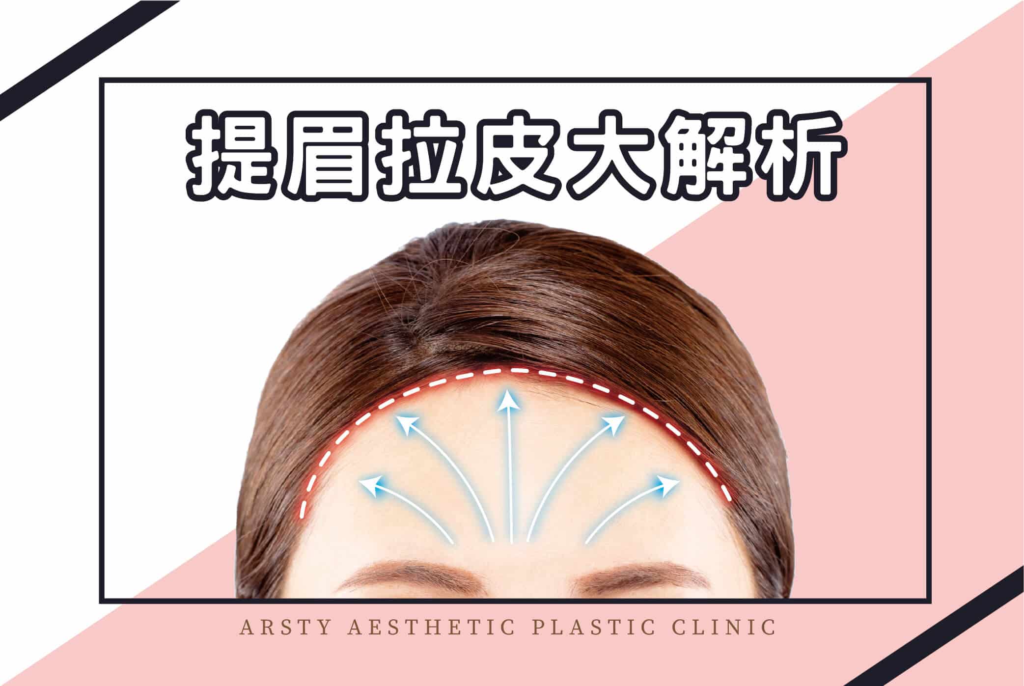 Medical News Cover - In-depth Analysis of Brow Lift and Facelift_16-1