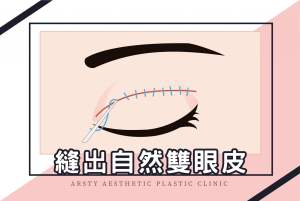 醫學新知封面-縫出自然雙眼皮_11-scaled-3