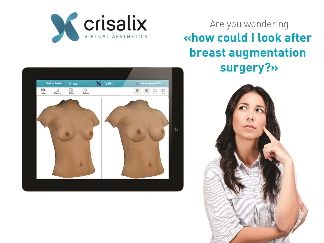 crisalix整形手術模擬諮詢 3
