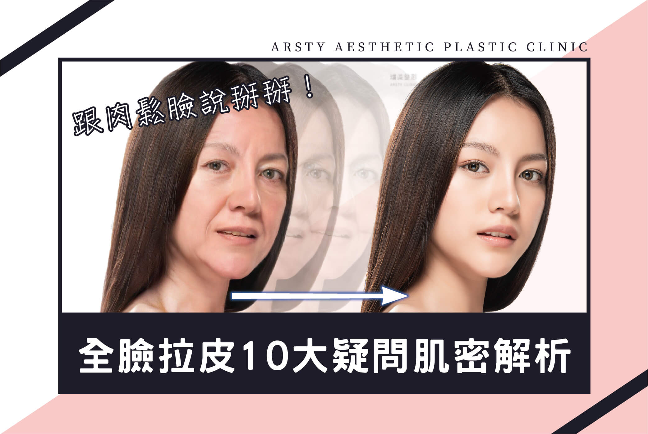 10 Questions About Saying Goodbye to Sagging Face and Full Facelift