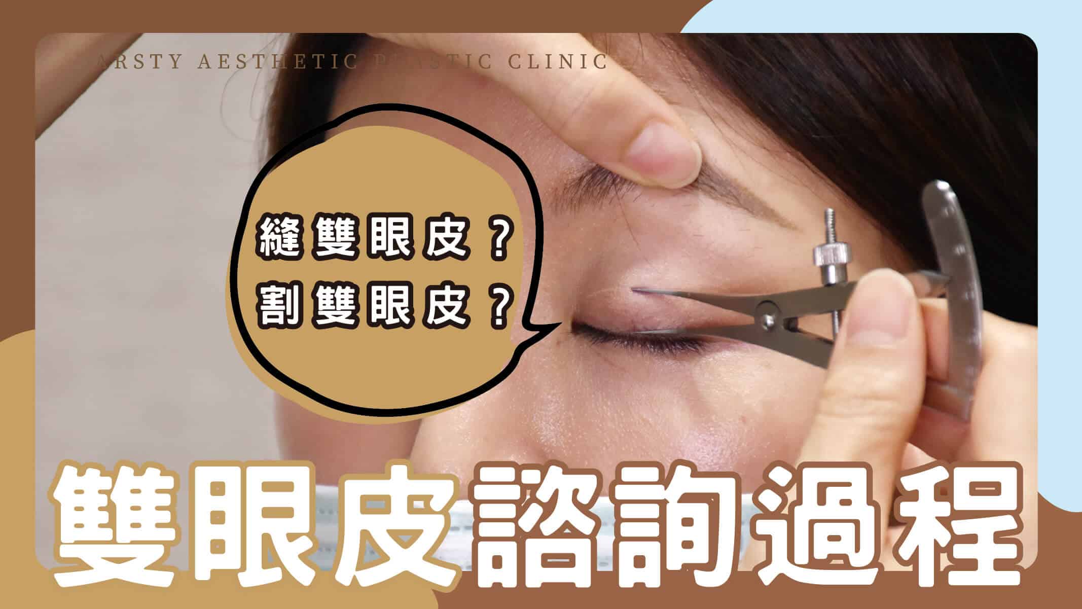 YouTube動画カバー_02 二重まぶたのシミュレーション相談