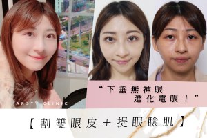 案例封面all57