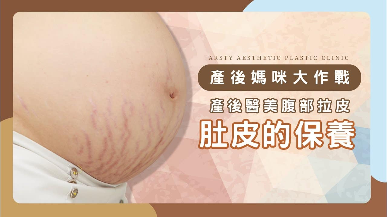 Postpartum belly care – the golden opportunity to combat sagging and stretch marks