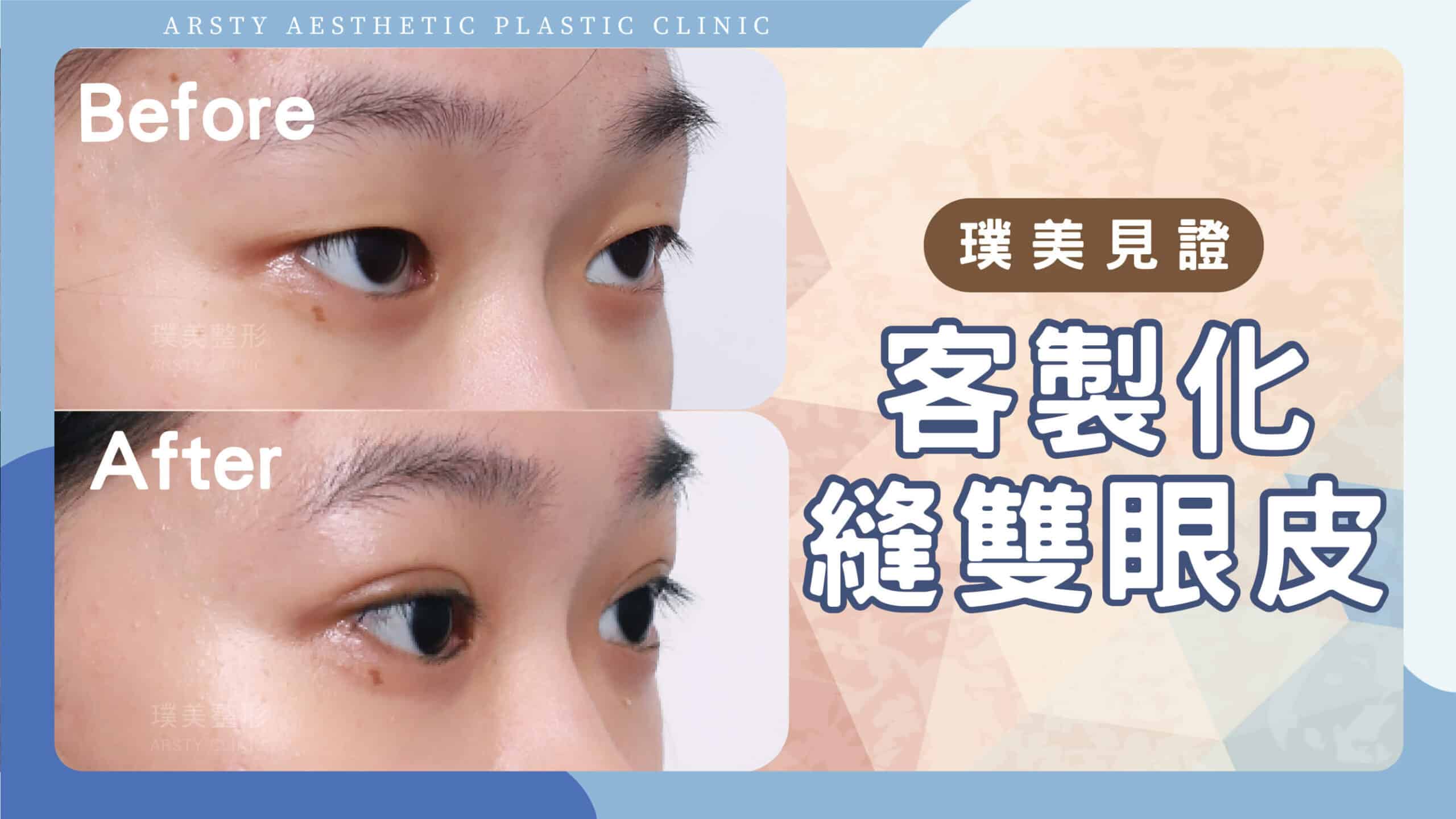 YouTube video cover - B220918-scaled-1
