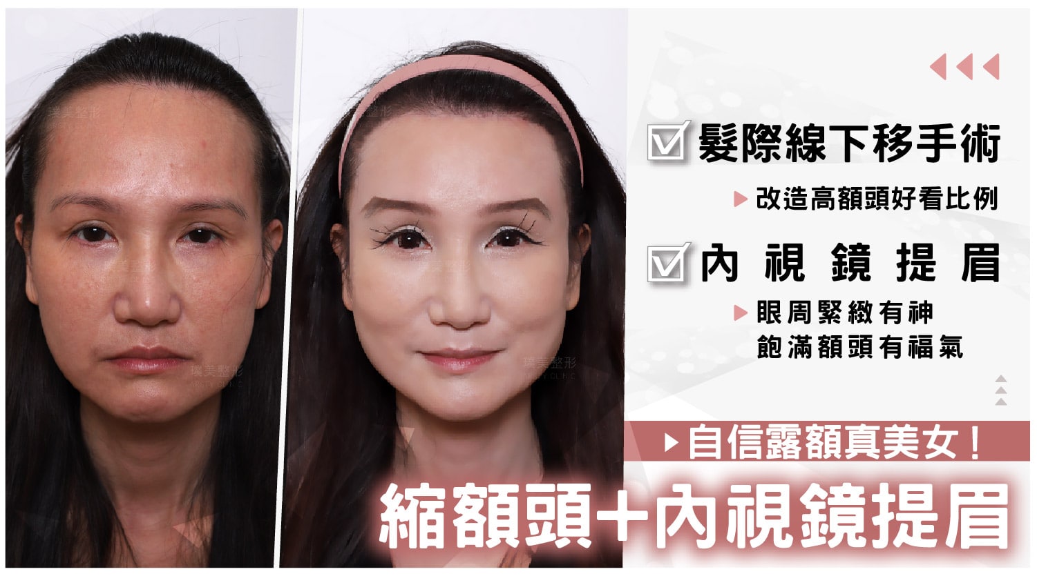 D220702 Hairline_banner_04