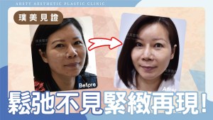 YouTube video cover - Zhao_01
