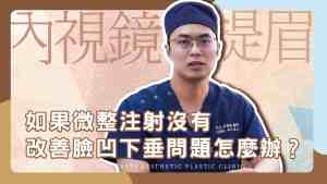 YouTube video cover_30 Eyebrow lift 01