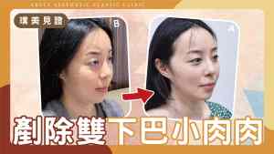 YouTube video cover - D220408 - 2_01