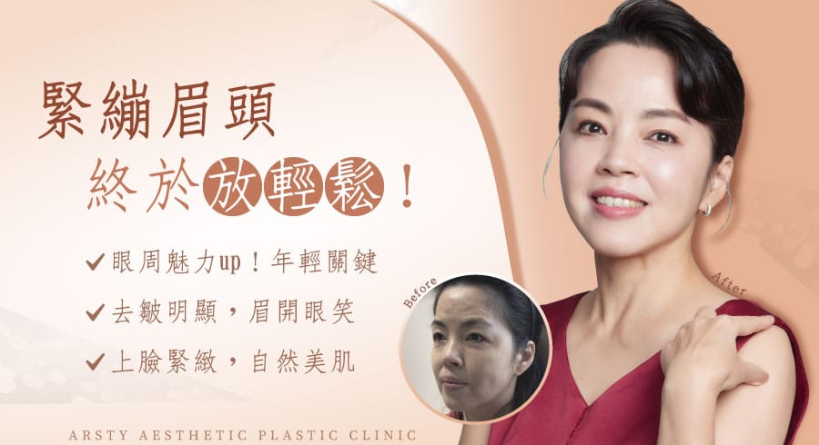 open method double eyelid — Endoscopic Forehead Lift - double eyelid surgery_D220722-banner_04