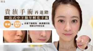 D221025-ゴアテックス ブルーダイヤモンド フィッシュボーン スレッドリフト たるみと鼻の溝の凹みを改善 - 1