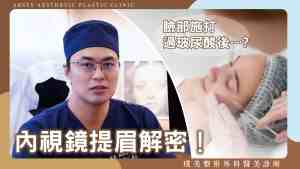 YouTube video cover_43 Dr. Wei-Cheng Ching - Can I still have an Endoscopic Forehead Lift after hyaluronic acid injections? -scaled-1