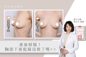 ヤン・シャンチュン博士の視点 - 産後の乳房の問題 (2008)
