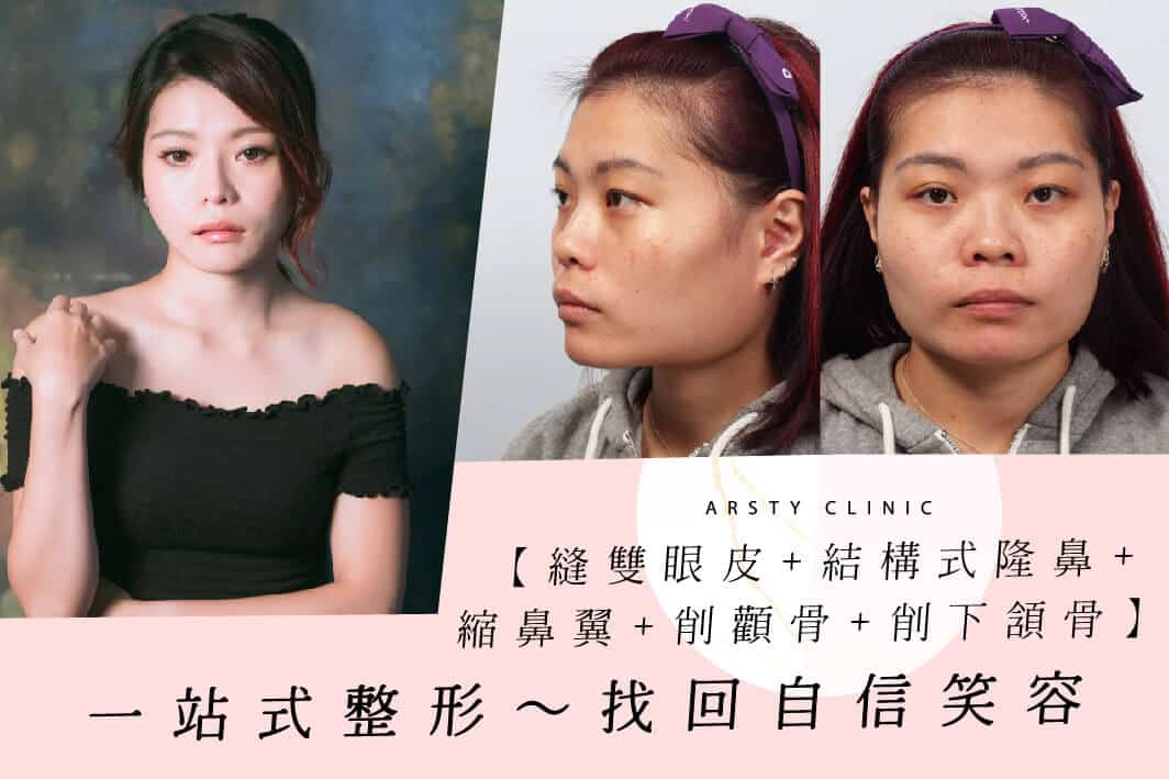 Arsty Clinic Cheekbone Reduction and Jawbone Reduction Case Study_A012202021_Cover