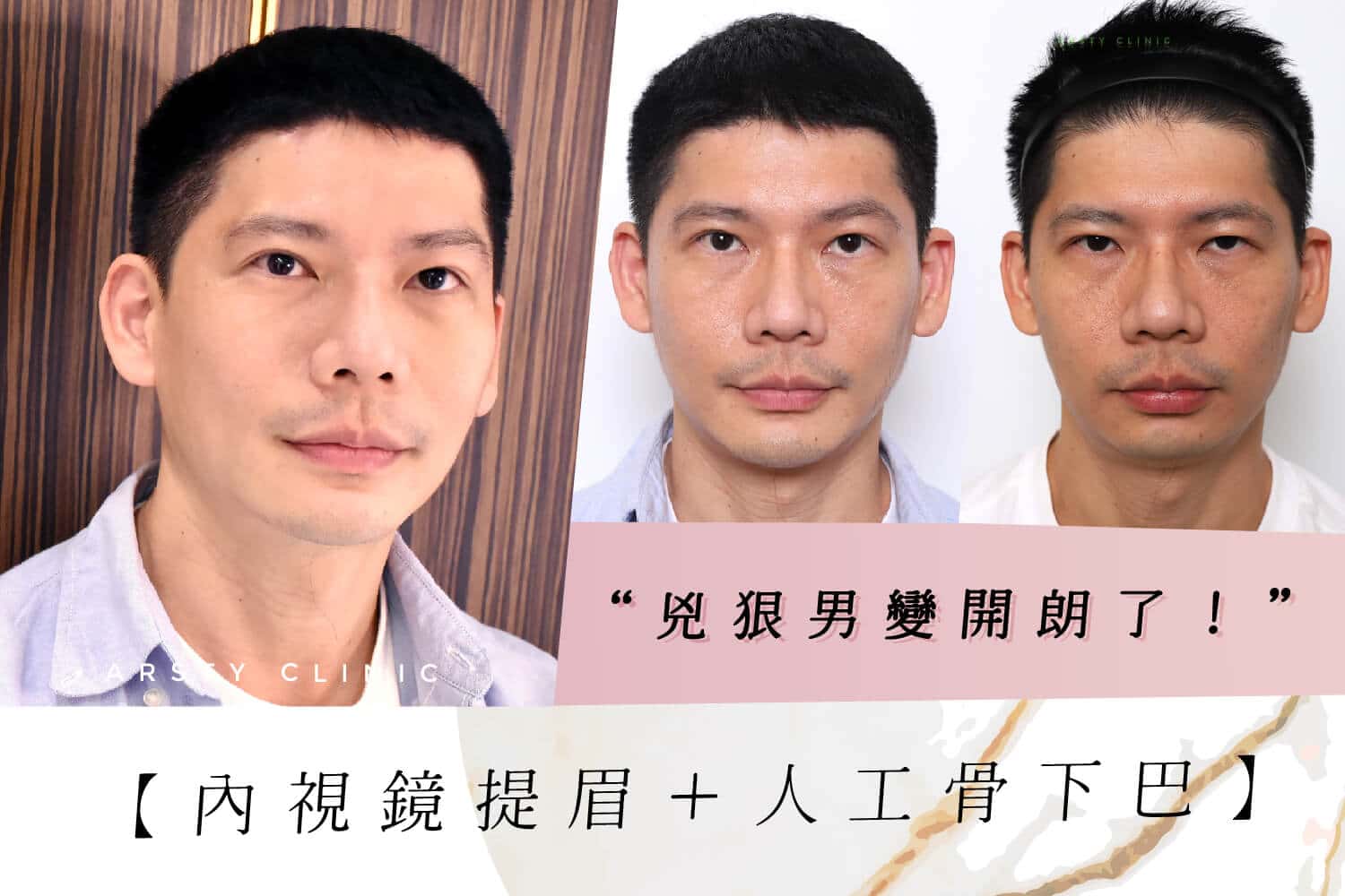案例封面all58