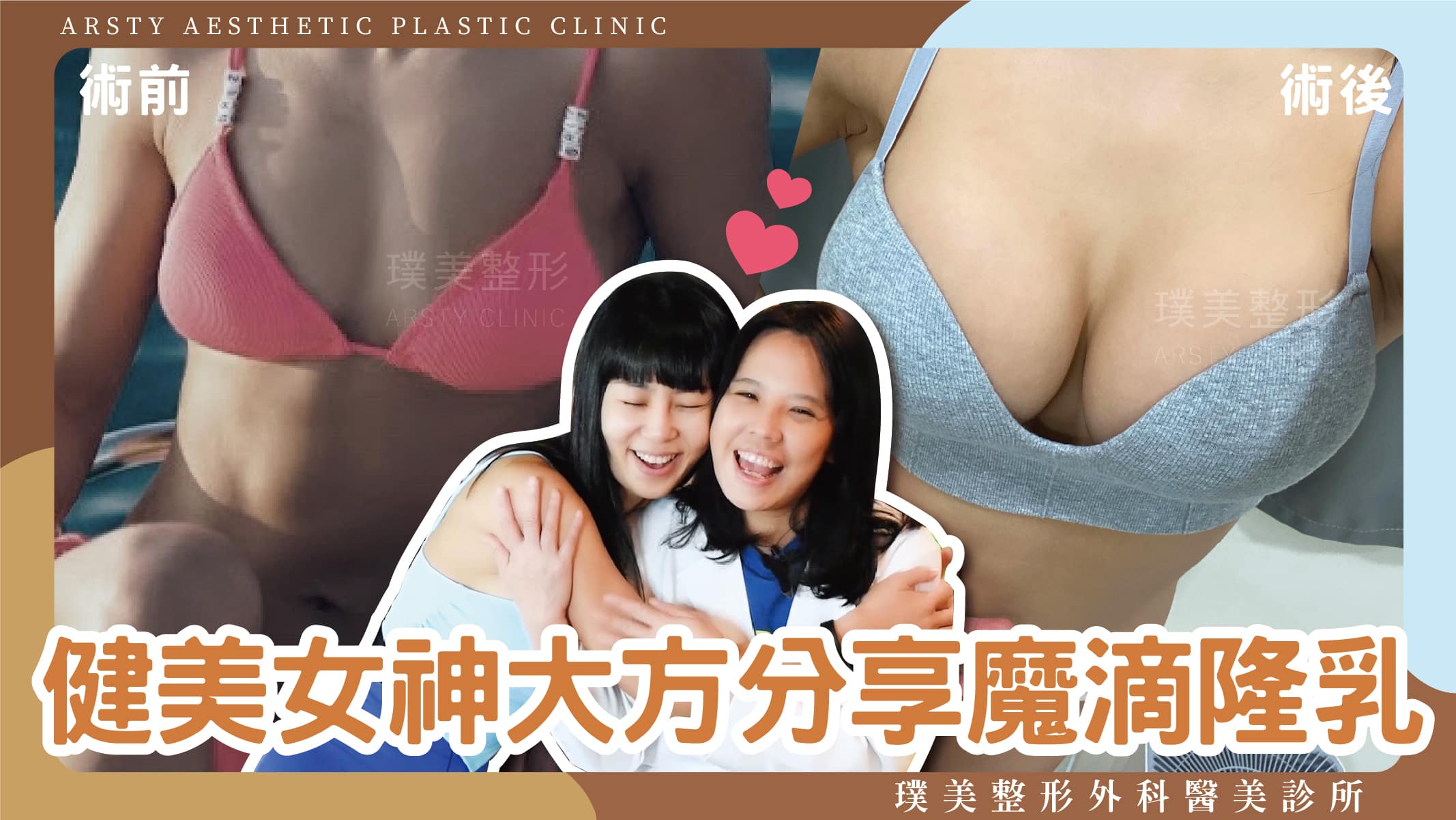 隆乳術後分享封面_Arsty Clinic女醫魔滴隆乳_01
