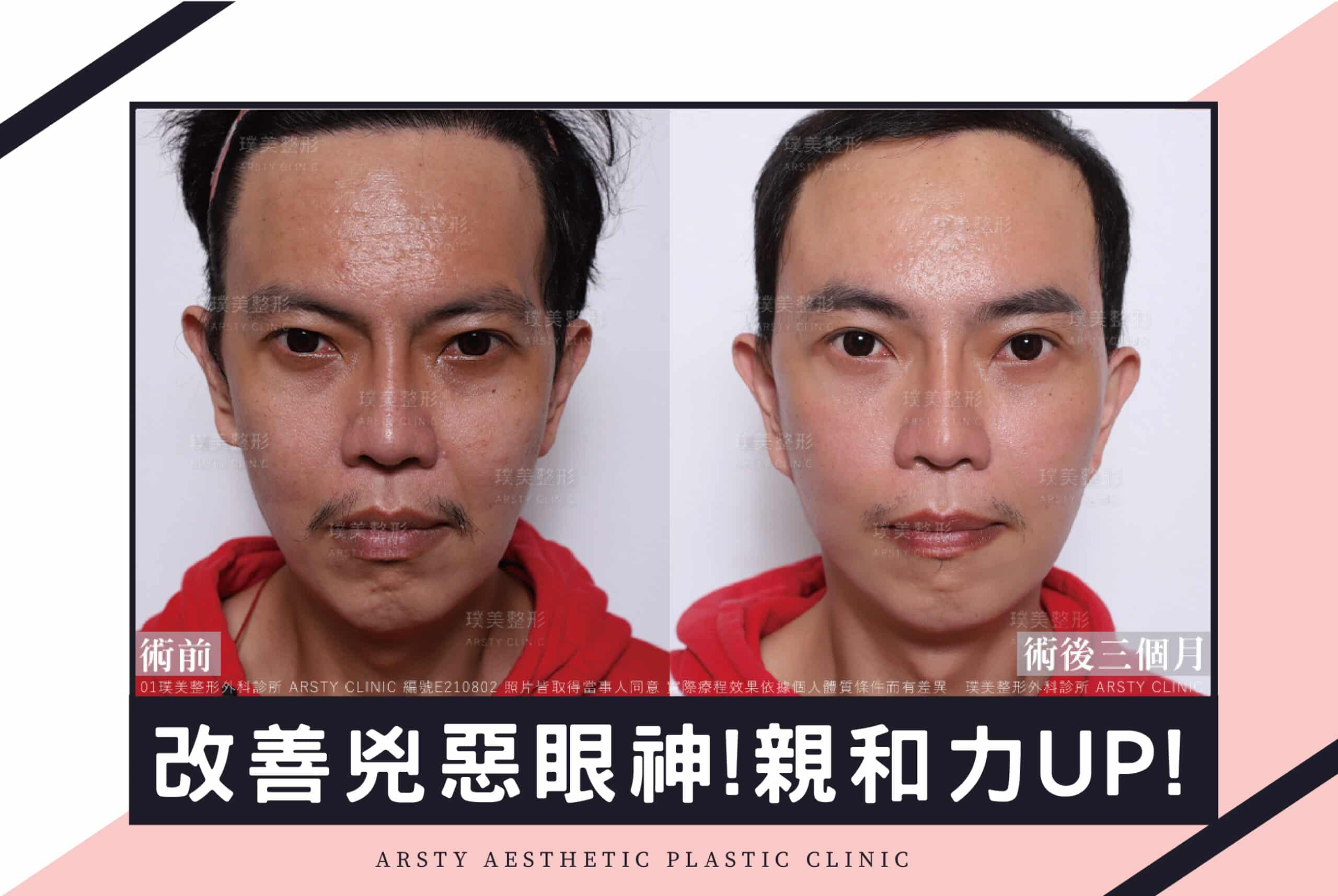 Arsty Clinic Medical Insights_Cover 36_Men Can Also Get a Facelift - Scaled - 1