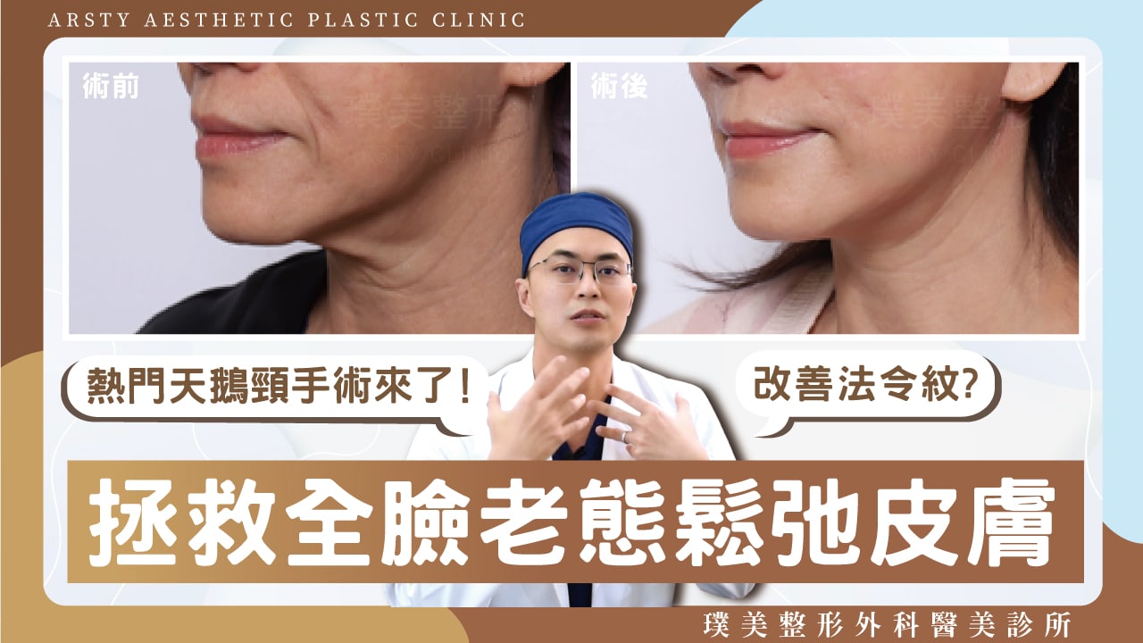 Arsty Clinic Video - Dr. Wei-Cheng Ching - 05 Popular Swan Neck Surgery is Here!