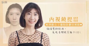 璞美整形外科內視鏡提眉案例荊偉政醫師陳心瑜醫師_E220704
