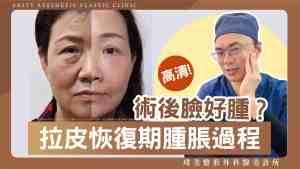 Arsty Clinic影片_荊偉政醫師_11臉部拉皮術後的腫脹期-scaled-1