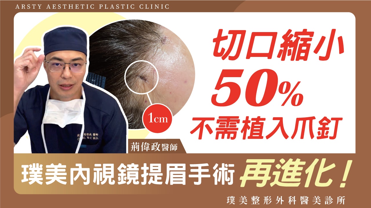 Arsty Clinic Video - Dr. Wei-Cheng Ching - 16 Endoscopic Forehead Lift with Reduced Incision