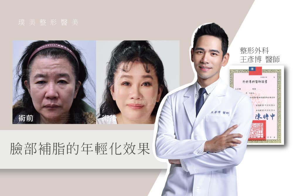 Dr. Wang's Viewpoint_02_The Rejuvenating Effect of Facial Fat Replenishment