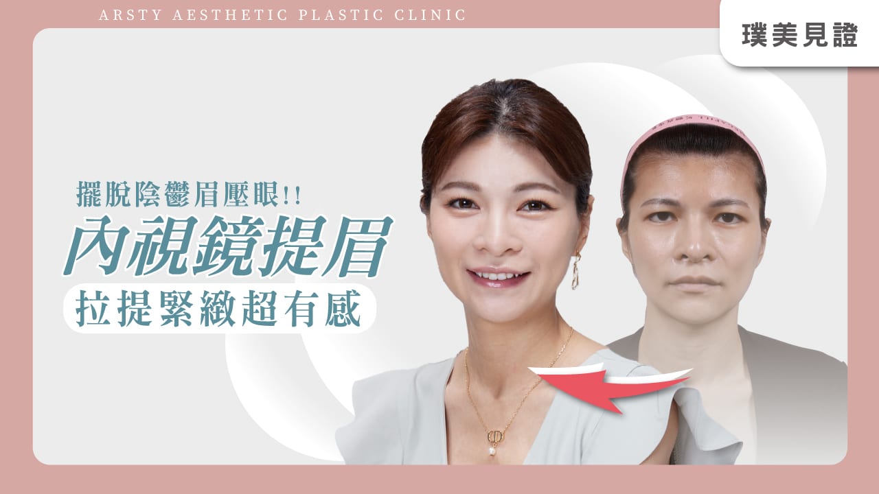 YT影片封面-內視鏡提眉F220928-1